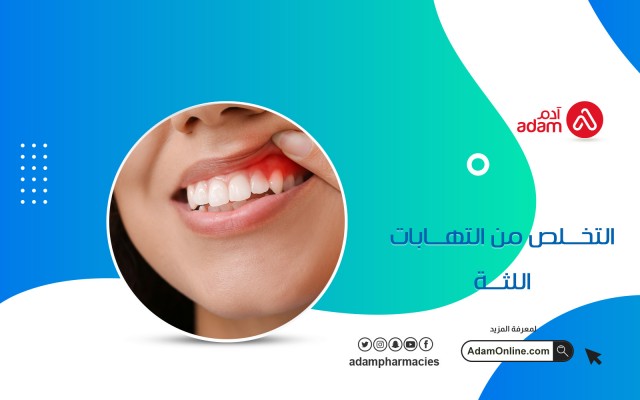 التخلص من التهابات اللثة
