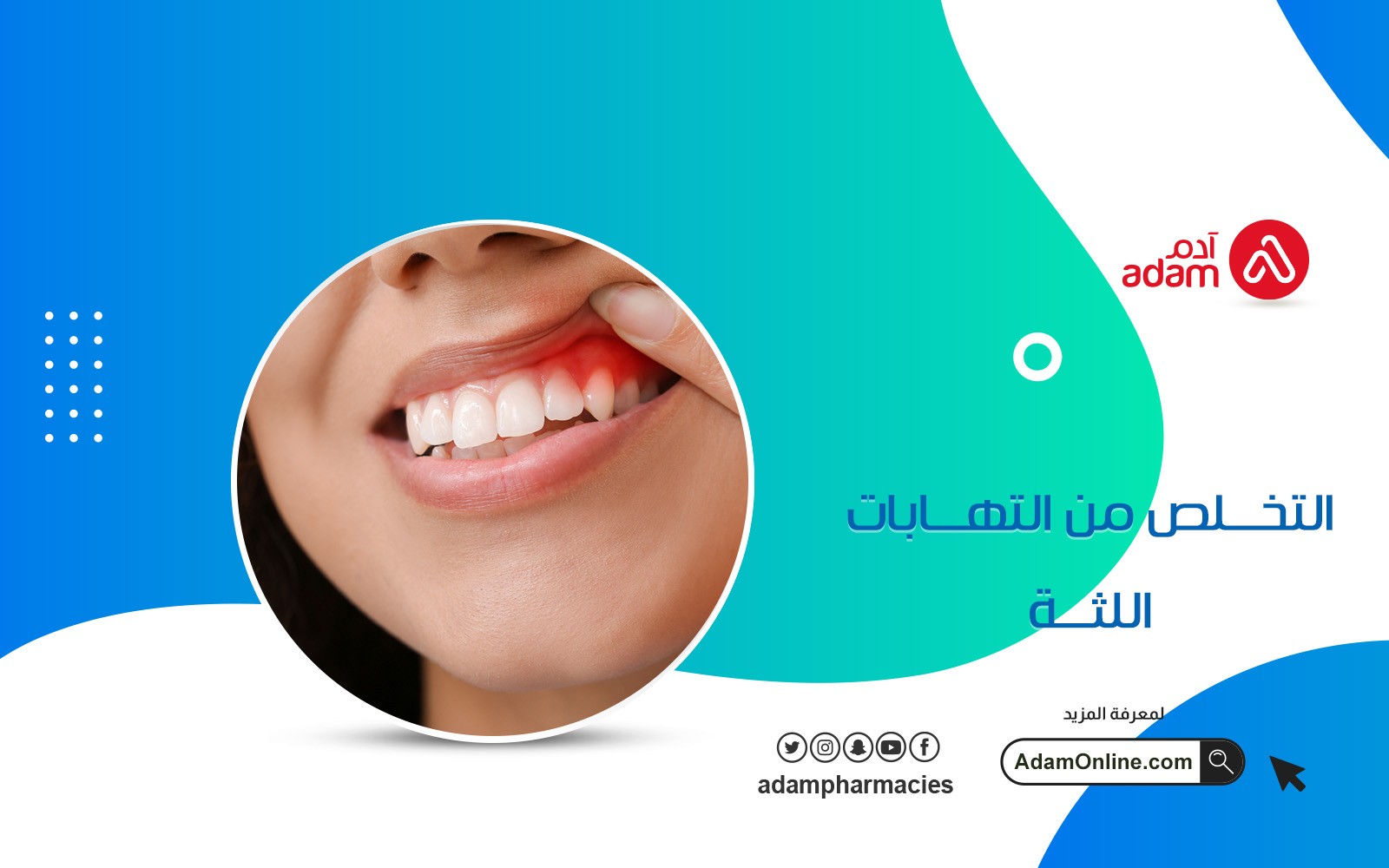 التخلص من التهابات اللثة